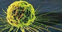 Rischio da esposizione a sostanze cancerogene Rischio da esposizione a sostanze cancerogene