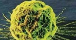 Cosa cambia se una sostanza è riconosciuta come agente chimico cancerogeno? Cosa cambia se una sostanza è riconosciuta come agente chimico cancerogeno?