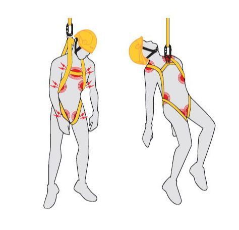 Harness hang syndrome