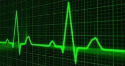 Il sovraccarico biomeccanico degli arti superiori in ambito sanitario Il sovraccarico biomeccanico degli arti superiori in ambito sanitario
