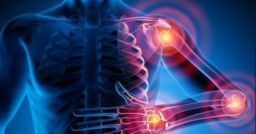 Sovraccarico biomeccanico e fabbricazione di organi di trasmissione Sovraccarico biomeccanico e fabbricazione di organi di trasmissione
