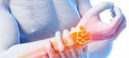 Sovraccarico biomeccanico: valutazione dei rischi e prevenzione Sovraccarico biomeccanico: valutazione dei rischi e prevenzione