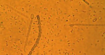 I rischi biologici e la prevenzione nelle bioraffinerie da microalghe