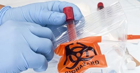 Il rischio biologico occupazionale nei laboratori non sanitari di analisi Il rischio biologico occupazionale nei laboratori non sanitari di analisi