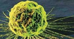 Rischi cancerogeni: le indicazioni del D.Lgs 81/08 e dell'INAIL Rischi cancerogeni: le indicazioni del D.Lgs 81/08 e dell'INAIL